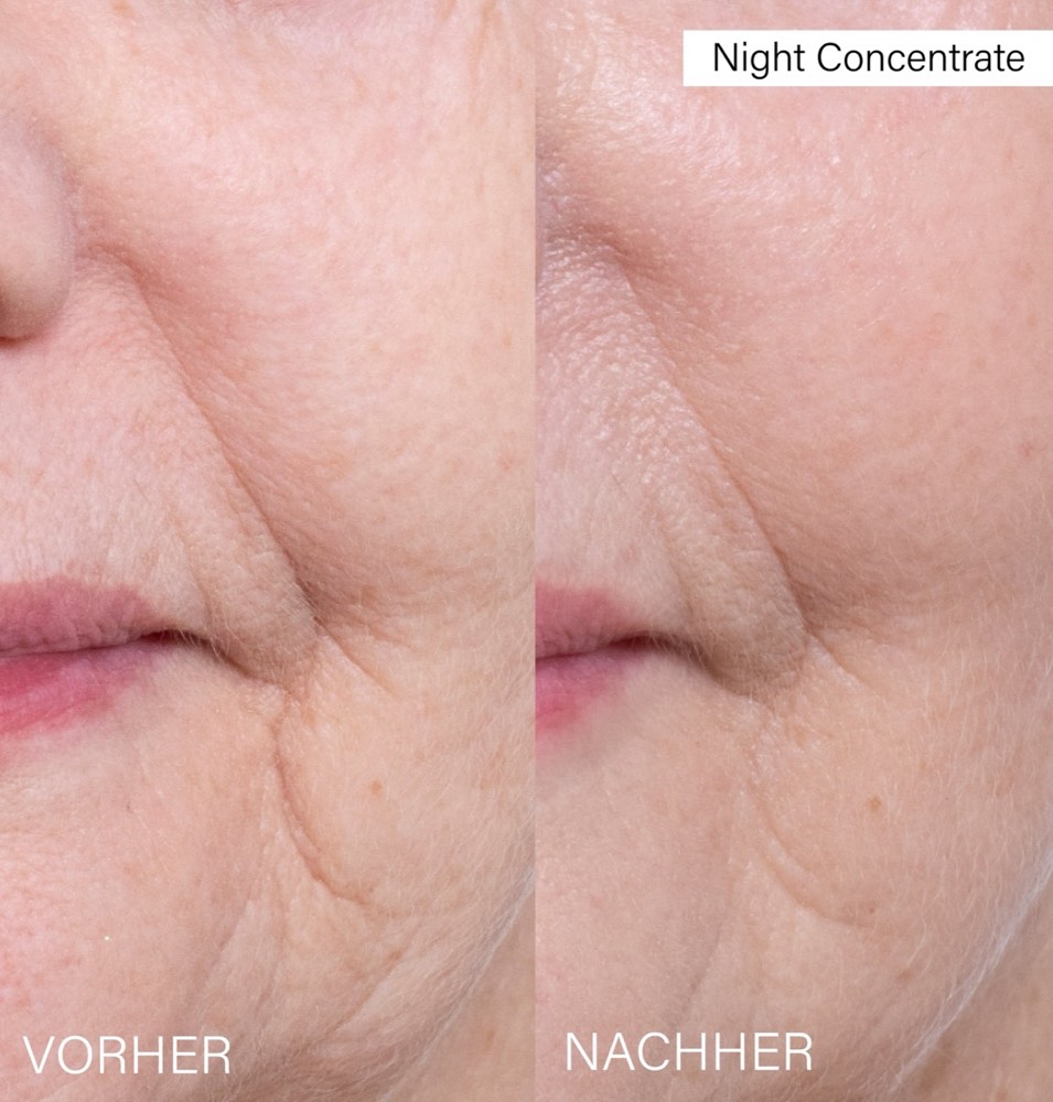 24h Glow Filler Duo – 4