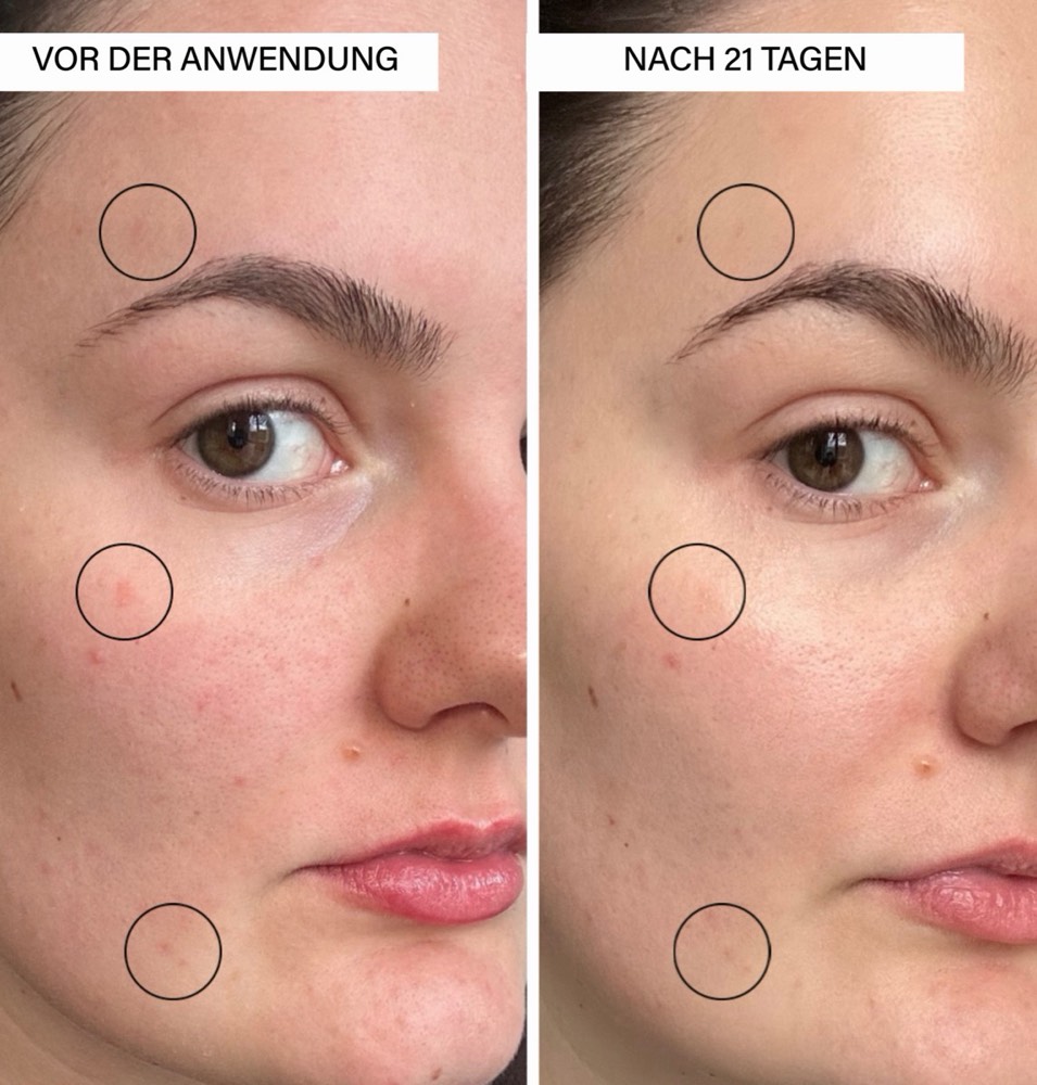 Brightening Serum – 4