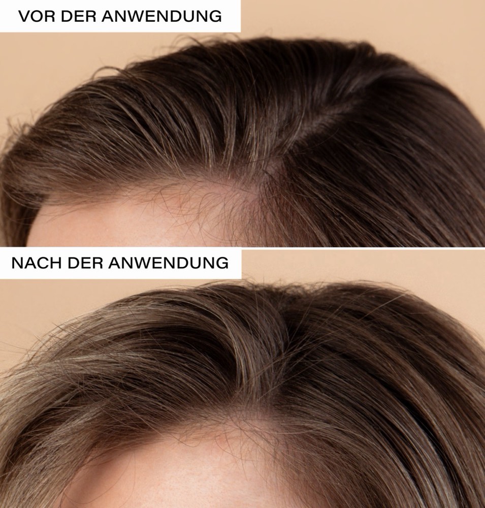 Natural Dry Shampoo – 4