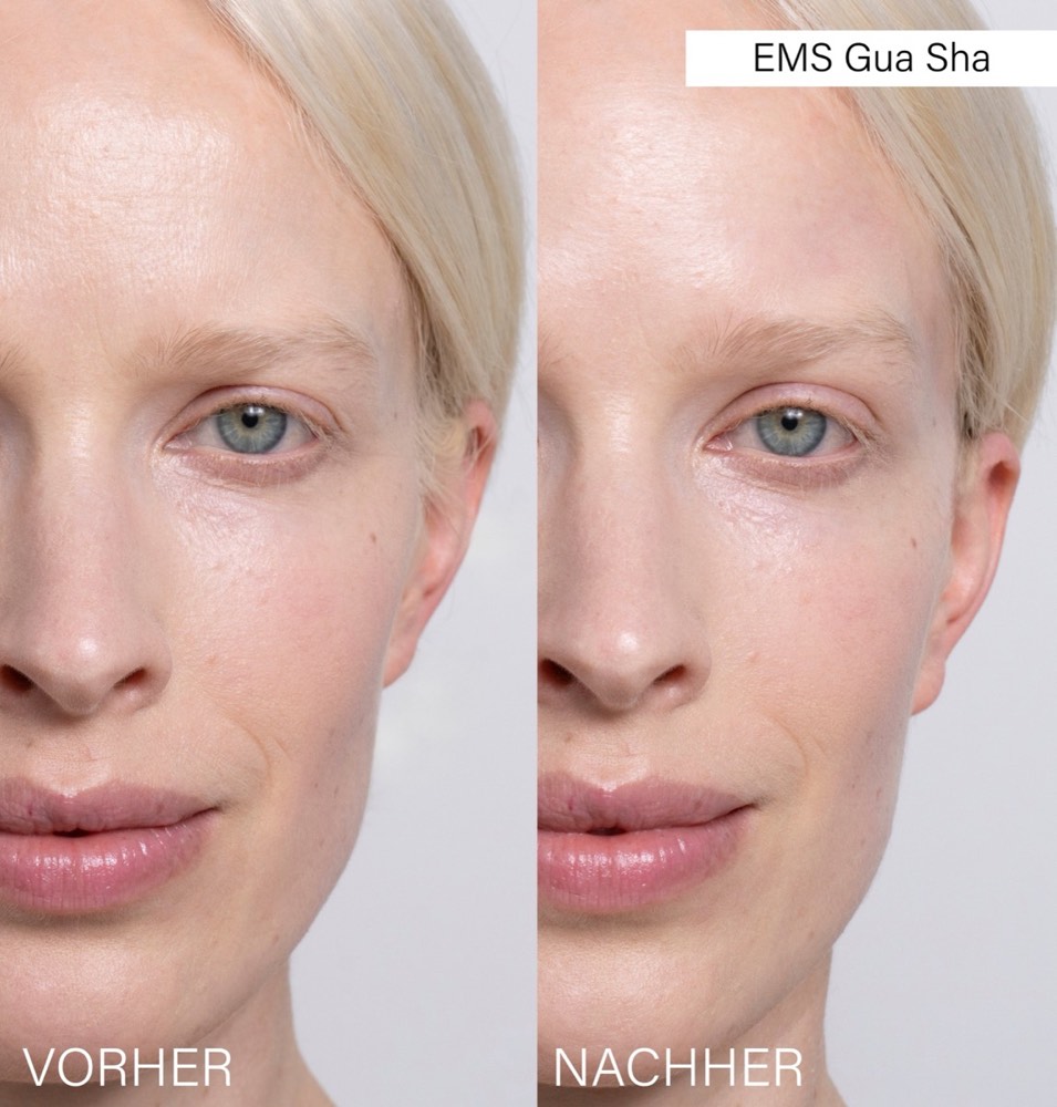 EMS Face Yoga Duo – 3