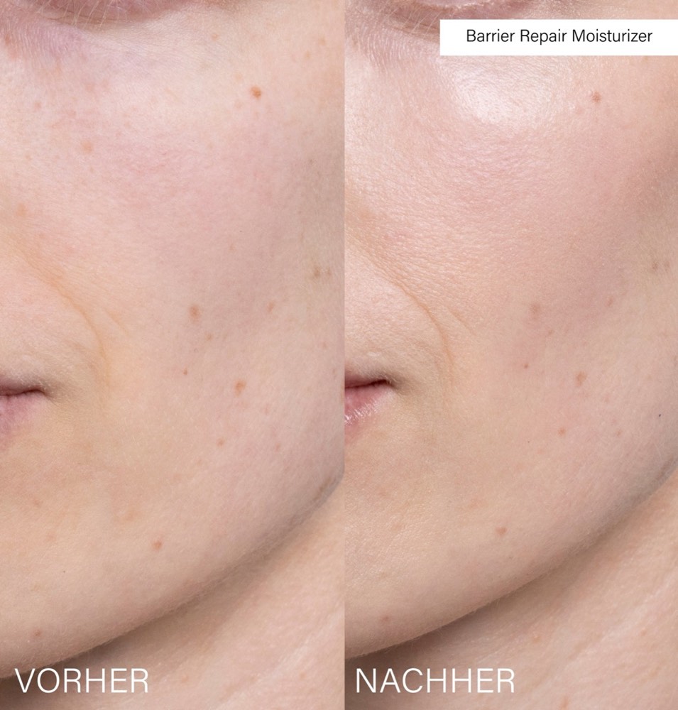 Barrier Repair Moisturizer – 3