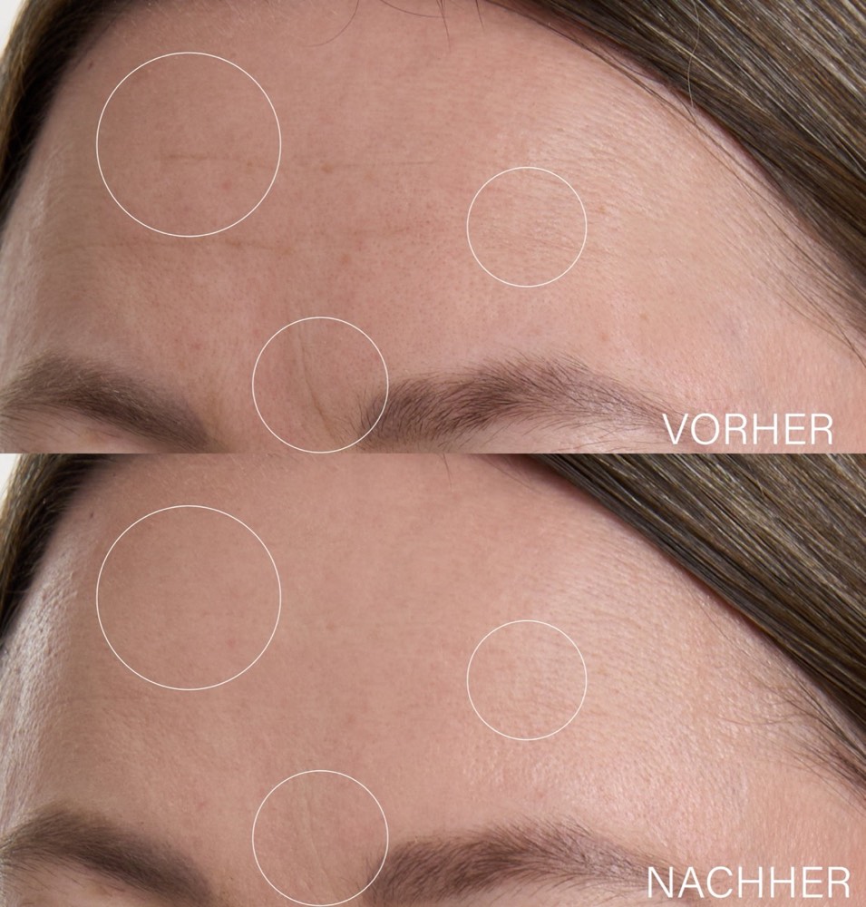 Botanical Lifting Effect Serum – 3