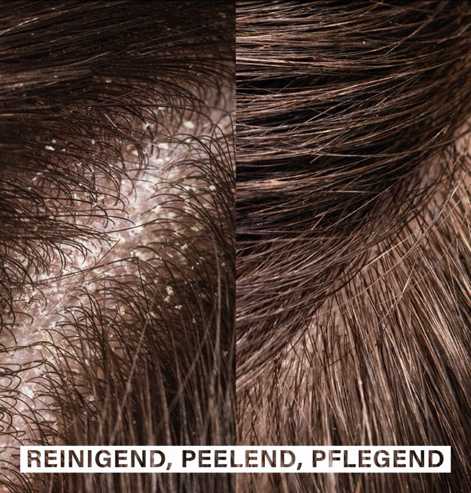 Scalp Exfoliating Shampoo – 4
