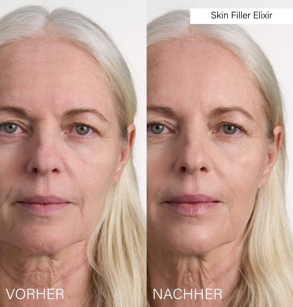 Skin Filler Elixir – 3