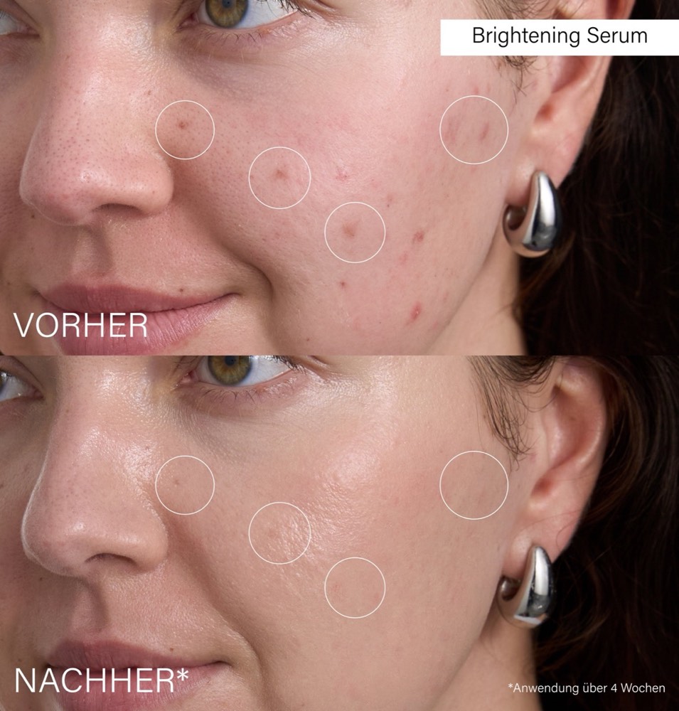 Brightening Serum – 5
