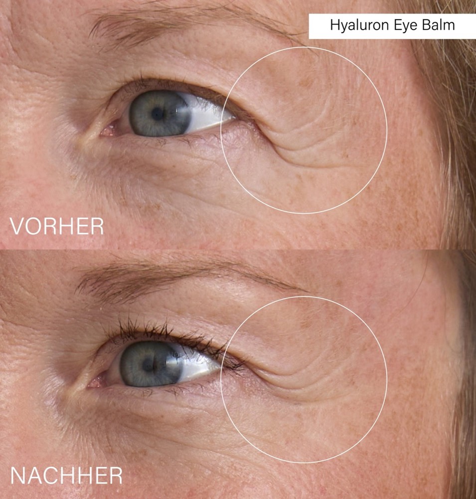 Advanced Slow-Aging Set – 3