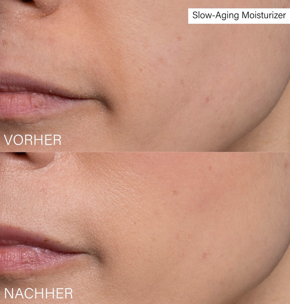 Slow-Aging Moisturizer – 3