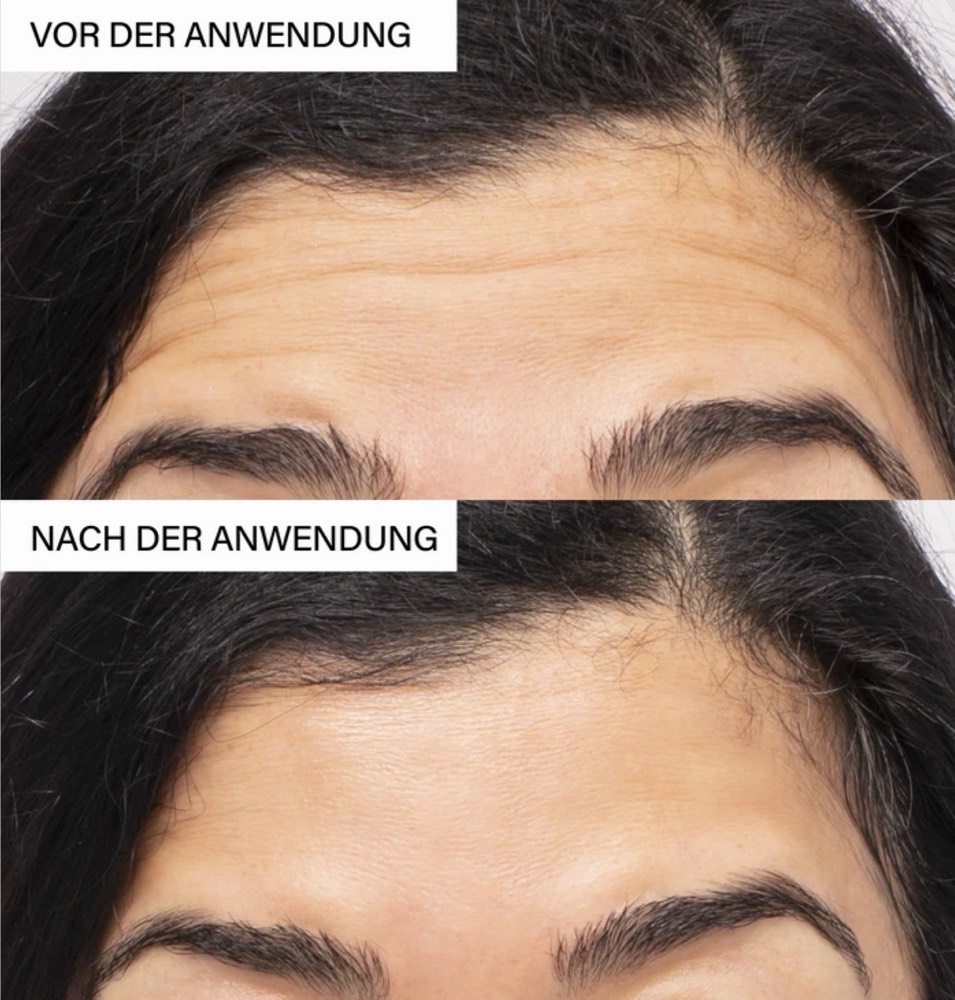 Lifting & Glow Duo – 4